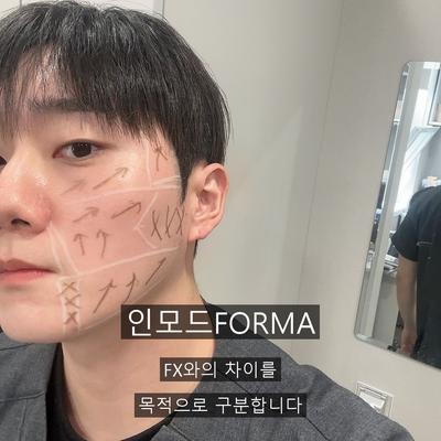 인모드FORMA, 인모드FX와 차이 총정리 이미지 1