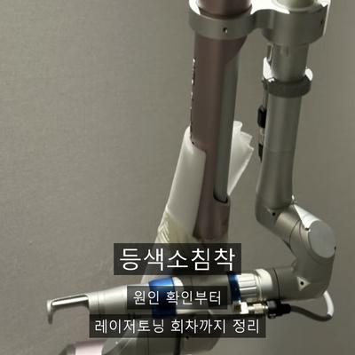 등색소침착, 레이저토닝으로 어떻게 개선할까? 이미지 1