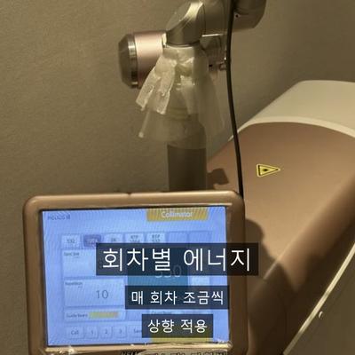 레이저토닝 치료기관을 고를 때 확인할 기준, 상담·설계·사후관리 순서로 정리 이미지 8
