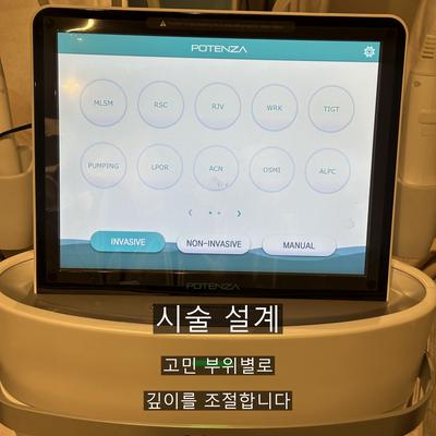 여드름흉터 치료기관을 고를 때 확인할 기준 3가지 이미지 4