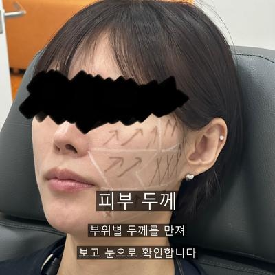울쎄라 치료기관을 고를 때 확인할 기준 세 가지, 상담부터 사후 기록까지 이미지 3
