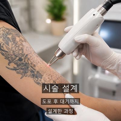 문신제거 치료기관을 고를 때 확인할 기준 이미지 4
