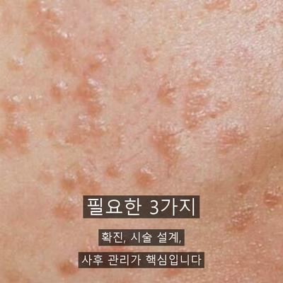 편평사마귀재발, 자꾸 다시 올라오는 이유와 관리법 이미지 5
