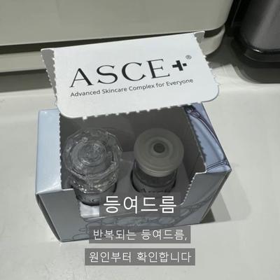 등여드름없애는법, 집에서 안 되는 이유와 병원과의 차이 이미지 1
