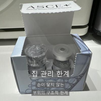 등여드름없애는법, 집에서 안 되는 이유와 병원과의 차이 이미지 3