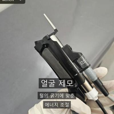 여성제모, 부위별로 몇 회 받아야 할까? 총정리 이미지 3