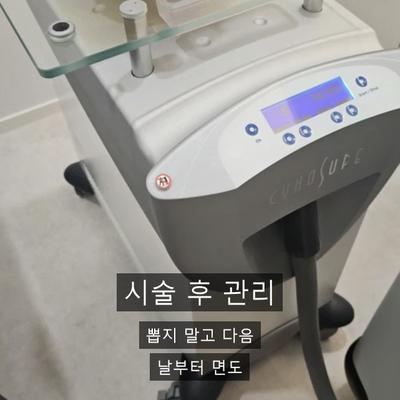 여성제모, 부위별로 몇 회 받아야 할까? 총정리 이미지 6