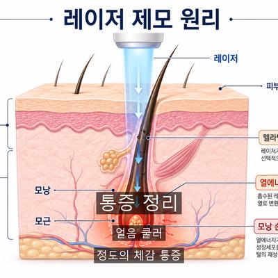 레이저제모브라질리언, 처음 받기 전 알아야 할 3가지 이미지 4