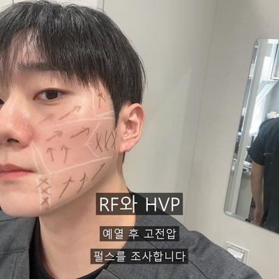 코리프팅, 인모드FX로 어떻게 개선할까? 이미지 4