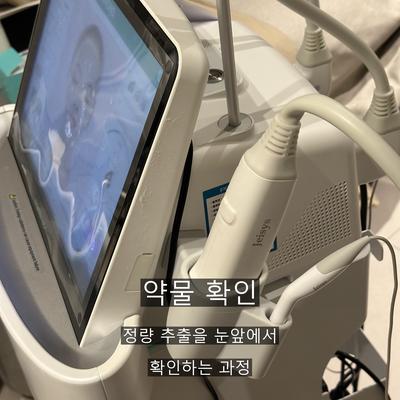 여드름 치료기관을 고를 때 확인할 기준 3가지, 진단부터 사후 관리까지 이미지 5