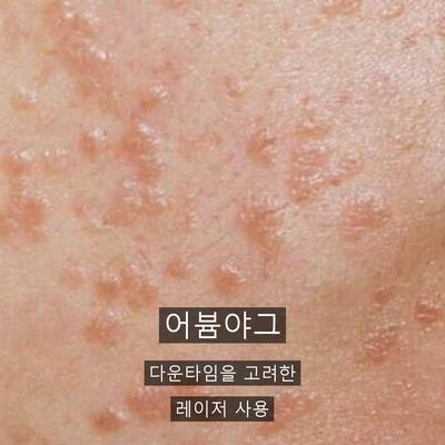 점제거 치료기관을 고를 때 확인할 기준, 진단부터 사후관리까지 이미지 5