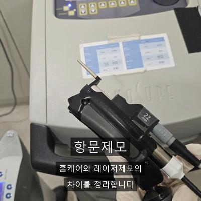 항문제모크림, 자극 때문에 반복이 어려운 이유와 레이저제모 차이 이미지 1