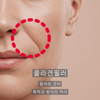 콜라겐필러 vs 코바 효과 추천대상 비교 이미지 1