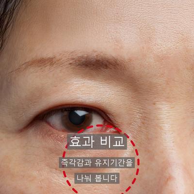 콜라겐필러 vs 코바 효과 추천대상 비교 이미지 3