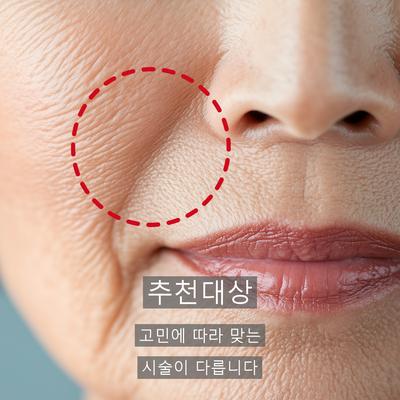 콜라겐필러 vs 코바 효과 추천대상 비교 이미지 5