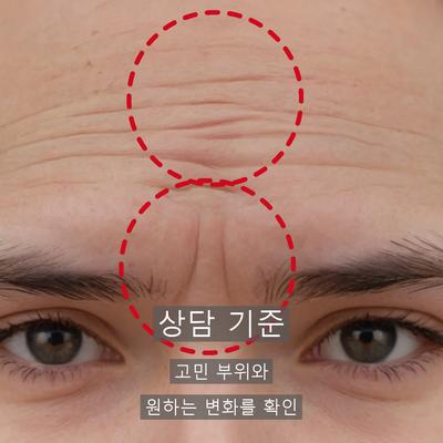 콜라겐필러 vs 코바 효과 추천대상 비교 이미지 8