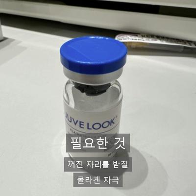 수두흉터치료, 쥬베룩으로 어떻게 개선할까? 이미지 4