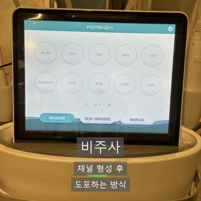 수두흉터치료, 쥬베룩으로 어떻게 개선할까? 이미지 7