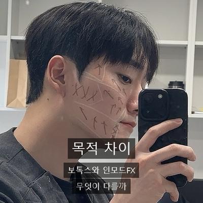 보톡스피부과 찾으신다면? 인모드FX와 목적 차이 정리 이미지 1