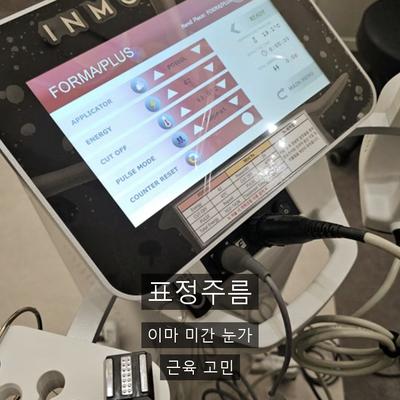 보톡스피부과 찾으신다면? 인모드FX와 목적 차이 정리 이미지 3