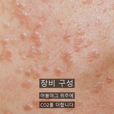 CO2레이저가격보다 점빼기에서 먼저 확인할 3가지 이미지 4