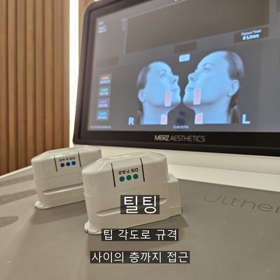 울쎄라인모드, 두 리프팅의 차이와 추천대상 총정리 이미지 8