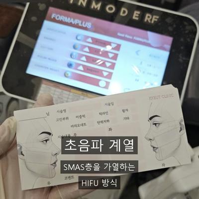 페이스리프팅 종류 총정리, 인모드FX는 어디에 속할까? 이미지 2