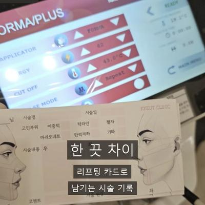 페이스리프팅 종류 총정리, 인모드FX는 어디에 속할까? 이미지 9