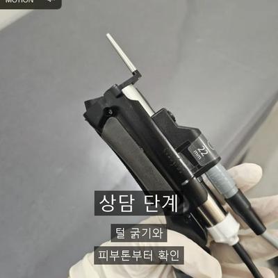 레이저제모 치료기관을 고를 때 확인할 3가지 기준 이미지 2