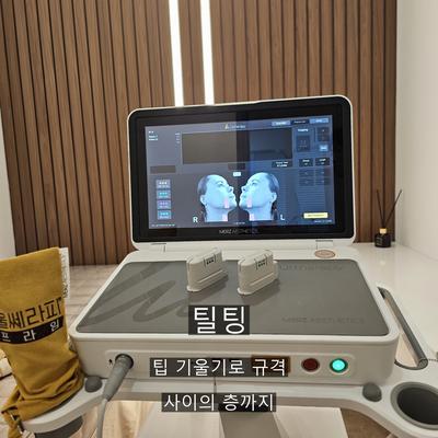울쎄라 시술기관을 고를 때 확인할 기준 3가지, 디자인과 초음파 확인 그리고 시술 기록 이미지 6