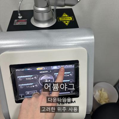 점제거 치료기관을 고를 때 확인할 기준 이미지 5