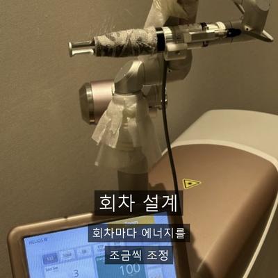 레이저토닝 치료기관을 고를 때 확인할 기준 정리 이미지 7