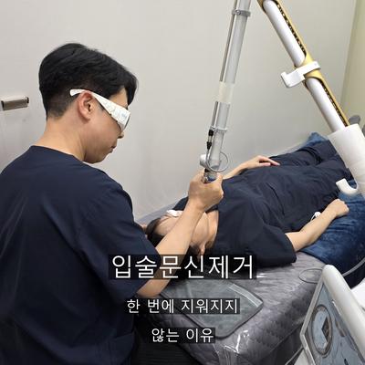 입술문신제거, 한 번에 지워지지 않는 이유 이미지 1