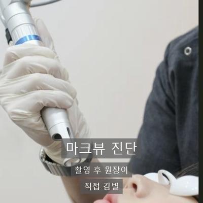 피부검버섯, 생기는 이유와 레이저 제거 과정 정리 이미지 5