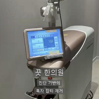 피부검버섯, 생기는 이유와 레이저 제거 과정 정리 이미지 8