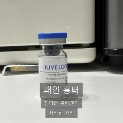 코여드름흉터, 잘 안 메워지는 이유와 쥬베룩 치료 원리 이미지 3