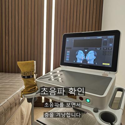 울쎄라 시술기관을 고를 때 확인할 기준 3가지, 상담부터 사후 관리까지 이미지 5