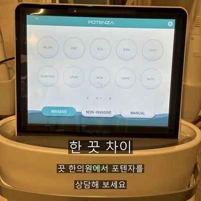 피부과MTS 대신 포텐자? 효과와 추천대상 비교 이미지 9