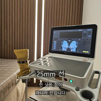 울쎄라시술, 1회로 효과가 오래가는 원리와 추천대상 이미지 3