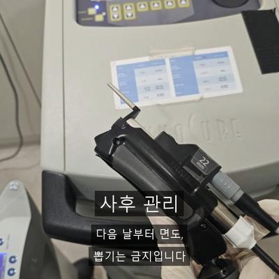 이마제모, 헤어라인 정리가 레이저로 깔끔한 이유 이미지 6