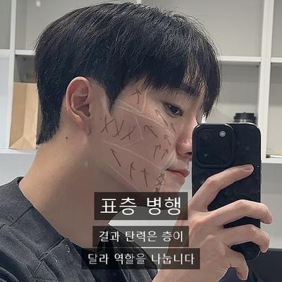 울쎄라피부과, 어떤 분들에게 추천드릴까요? 이미지 5