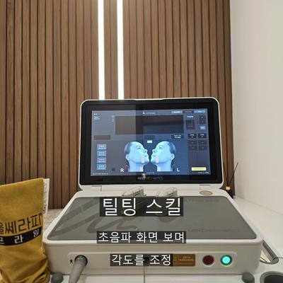 피부과울쎄라, 통증이 걱정된다면 알아둘 시술 과정 정리 이미지 6