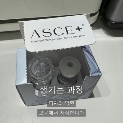 여드름시술, 엑소좀으로 어떻게 개선할까? 이미지 2