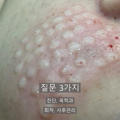 피부과상담, 시술 전에 꼭 확인할 3가지 질문 이미지 2
