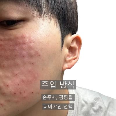 피부과상담, 시술 전에 꼭 확인할 3가지 질문 이미지 8