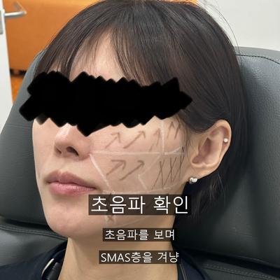 울쎄라 병원 고르는 기준, 상담·설계·사후관리 3단계로 확인할 항목 정리 이미지 5