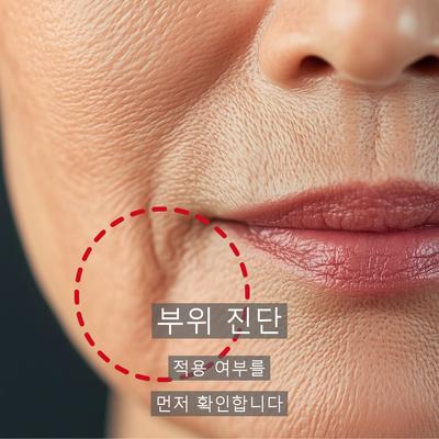 목주름필러가격 비용보다 체크해야 할 3가지 이미지 5