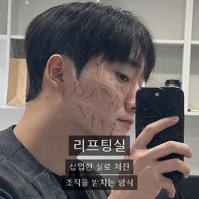 리프팅실 vs 온다리프팅 효과 추천대상 비교 이미지 2