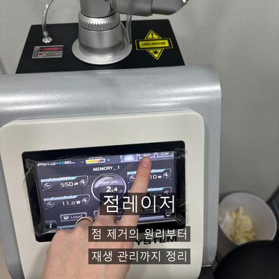 점레이저, 시술 후 재생 관리가 중요한 이유 이미지 1
