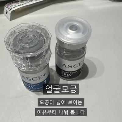 얼굴모공줄이는법, 포텐자로 어떻게 개선할까? 이미지 1